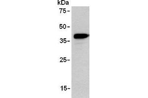 ANKRD2 antibody