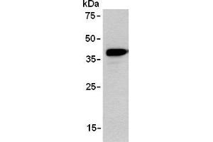 Western blot analysis of ARPP expression in TE-1 using AM26555AF-N. (ANKRD2 antibody)