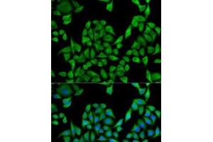 Immunofluorescence analysis of U2OS cells using UGT1A1 Polyclonal Antibody (UGT1A1 antibody)