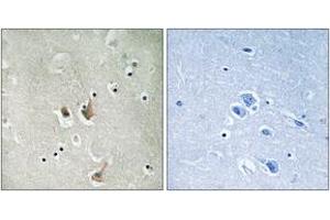 Immunohistochemistry analysis of paraffin-embedded human brain tissue, using CKS2 Antibody.