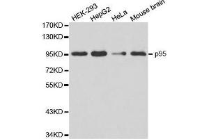 Western blot analysis of extracts of various cell lines, using NBN antibody. (Nibrin antibody  (AA 435-754))