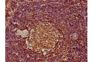 IHC image of ABIN7139928 diluted at 1:300 and staining in paraffin-embedded human lymph node tissue performed on a Leica BondTM system. (MDFIC antibody  (AA 35-53))