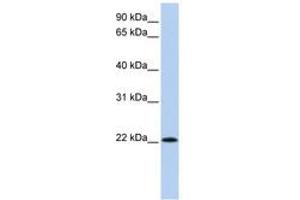 Image no. 1 for anti-Ribonuclease, RNase A Family, 11 (Non-Active) (RNASE11) (C-Term) antibody (ABIN6741184) (RNASE11 antibody  (C-Term))