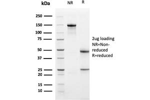 SDS-PAGE Analysis Purified TCF4 Mouse Monoclonal Antibody (PDL1/2741). (PD-L1 antibody  (AA 39-191))