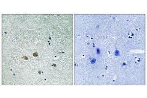 Immunohistochemistry (IHC) image for anti-P21-Activated Kinase 1 (PAK1) (Ser204) antibody (ABIN1848247) (PAK1 antibody  (Ser204))