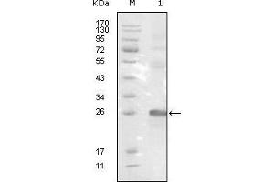 Western blot analysis using EphB3 mouse mAb against truncated EphB3-His recombinant protein.