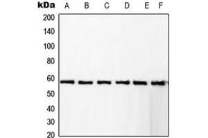 Western blot analysis of RCBTB1 expression in KNRK (A), Jurkat (B), A431 (C), HeLa (D), Raw264. (RCBTB1 antibody  (Center))