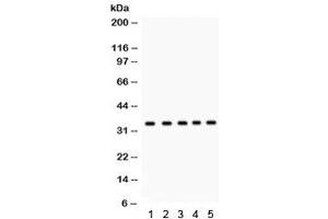 Western blot testing of 1) rat testis, 2) human 22RV1, 3) HeLa, 4) MCF7, and 5) Jurkat lysate with EBAG9 antibody. (RCAS1 antibody  (AA 31-213))