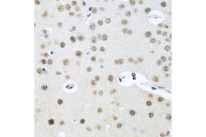 Immunohistochemistry of paraffin-embedded mouse brain using UTP14A antibody  at dilution of 1:100 (40x lens). (UTP14A antibody  (AA 1-260))