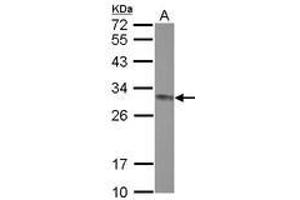 Image no. 2 for anti-ClpP Caseinolytic Peptidase, ATP-Dependent, Proteolytic Subunit Homolog (E. Coli) (CLPP) (AA 48-272) antibody (ABIN1497534) (CLPP antibody  (AA 48-272))