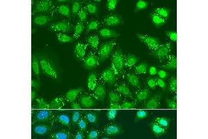 Immunofluorescence analysis of U2OS cells using HDAC4 Polyclonal Antibody at dilution of 1:100. (HDAC4 antibody)