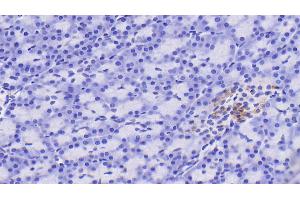 Detection of RBP4 in Human Pancreas Tissue using Polyclonal Antibody to Retinol Binding Protein 4 (RBP4) (RBP4 antibody)