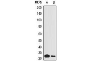 Western blot analysis of Complement C1QA expression in mouse lung (A), mouse liver (B) whole cell lysates. (C1QA antibody)