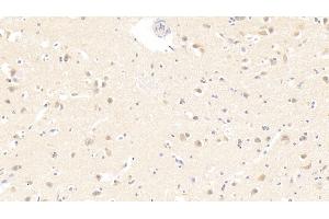 Detection of IL19 in Human Cerebrum Tissue using Monoclonal Antibody to Interleukin 19 (IL19) (IL-19 antibody  (AA 25-177))