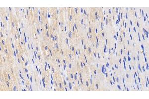 Detection of HIF2a in Human Cardiac Muscle Tissue using Polyclonal Antibody to Hypoxia Inducible Factor 2 Alpha (HIF2a) (EPAS1 antibody  (AA 339-541))