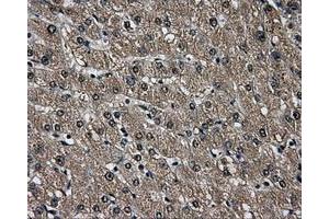 Immunohistochemistry (IHC) image for anti-Aldo-Keto Reductase Family 1, Member A1 (Aldehyde Reductase) (AKR1A1) antibody (ABIN1496539) (AKR1A1 antibody)