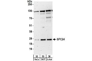 Western Blotting (WB) image for anti-SPC24, NDC80 Kinetochore Complex Component, Homolog (SPC24) (AA 1-50) antibody (ABIN7453209)