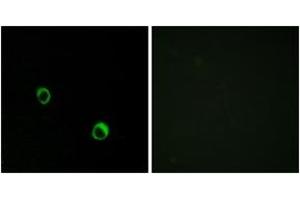 Immunofluorescence analysis of MCF7 cells, using CAR14 Antibody. (CA14 antibody  (AA 291-340))