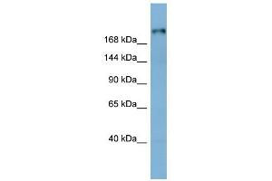 Laminin Beta 1 antibody used at 1 ug/ml to detect target protein.