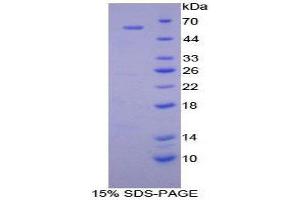 SDS-PAGE (SDS) image for Cathepsin A (CTSA) (AA 215-470) protein (His tag,GST tag) (ABIN1877479)