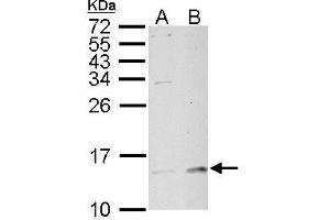 WB Image MP1 antibody detects MP1 protein by Western blot analysis. (MAPKSP1 antibody)