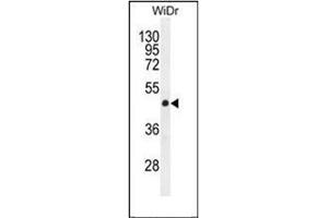 Western blot analysis of Gasdermin C Antibody (Center) in WiDr cell line lysates (35ug/lane).