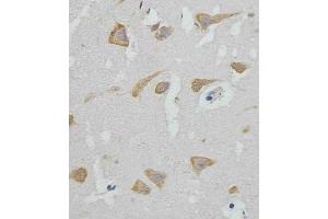 (ABIN388564 and ABIN2849716) staining GABAR in human brain tissue sections by Immunohistochemistry (IHC-P - paraformaldehyde-fixed, paraffin-embedded sections). (GABARAP antibody  (AA 1-30))
