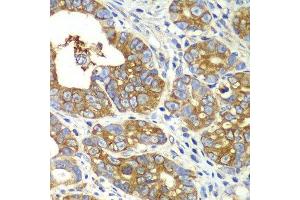 Immunohistochemistry (Paraffin-embedded Sections) (IHC (p)) image for anti-Glutaminyl-tRNA Synthetase (QARS) (AA 1-250) antibody (ABIN6146529)
