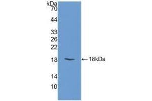 Detection of Recombinant FABP3, Bovine using Polyclonal Antibody to Heart-type Fatty Acid Binding Protein (H-FABP)