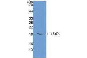 Detection of Recombinant FABP3, Bovine using Polyclonal Antibody to Heart-type Fatty Acid Binding Protein (H-FABP) (FABP3 antibody  (AA 1-133))