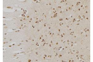 ABIN6276553 at 1/100 staining Human brain tissue by IHC-P. (DUSP6 antibody  (Internal Region))