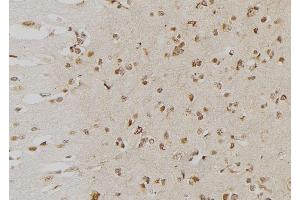 ABIN6276553 at 1/100 staining Human brain tissue by IHC-P. (DUSP6 antibody  (Internal Region))