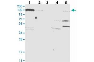 Western blot analysis of Lane 1: RT-4, Lane 2: U-251 MG, Lane 3: Human Plasma, Lane 4: Liver, Lane 5: Tonsil with NCOA7 polyclonal antibody  at 1:250-1:500 dilution.