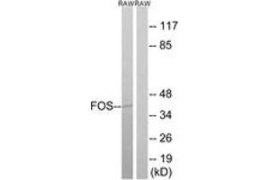 Western blot analysis of extracts from RAW264. (c-FOS antibody  (AA 15-64))