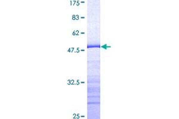 PTK2B Protein (AA 682-871) (GST tag)