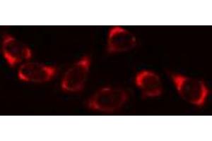 ABIN6269268 staining A549 cells by IF/ICC.