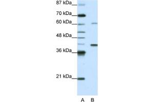 Western Blotting (WB) image for anti-Zinc Finger Protein 843 (ZNF843) antibody (ABIN2462025) (ZNF843 antibody)