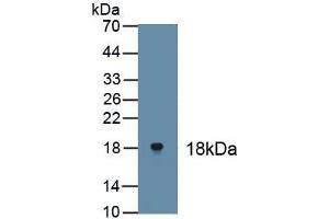 Detection of Recombinant TP63, Human using Polyclonal Antibody to Tumor Protein P63 (TP63) (p63 antibody)
