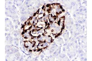 VIP was detected in paraffin-embedded sections of human pancreatic cancer tissues using rabbit anti- VIP Antigen Affinity purified polyclonal antibody (Catalog # ) at 1 ? (Vip antibody  (Middle Region))