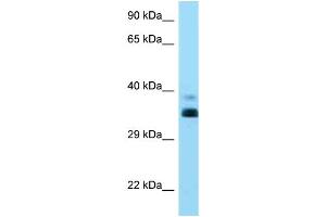 WB Suggested Anti-HLA-G Antibody Titration: 1. (HLAG antibody  (C-Term))