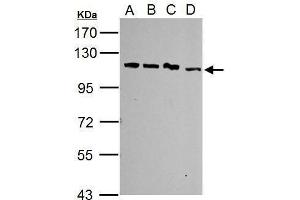 WB Image Sample (30 ug of whole cell lysate) A: Jurkat B: Raji C: K562 D: NCI-H929 7. (SART1 antibody  (Internal Region))