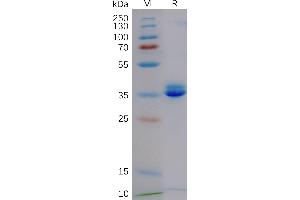 Cynomolgus GD Protein, hFc Tag on SDS-PAGE under reducing condition.