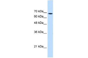 WB Suggested Anti-TGM2 Antibody Titration:  0. (Transglutaminase 2 antibody  (Middle Region))