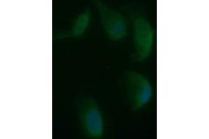 Image no. 2 for anti-Synaptophysin (SYP) antibody (ABIN1501259) (Synaptophysin antibody)