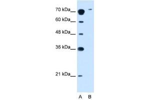 SLC7A14 antibody used at 2. (SLC7A14 antibody)