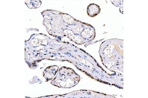 IHC analysis of LIN28B using anti-LIN28B antibody (ABIN7600743).