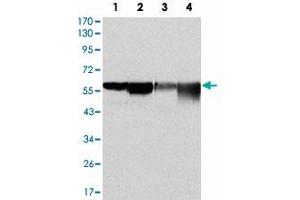 Western blot analysis using G6PD monoclonal antibody, clone 2H7  against HeLa (1) , MCF-7 (2) , Jurkat (3) and K-562 (4) cell lysate.