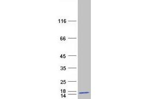 Western Blotting (WB) image for Biogenesis of Lysosomal Organelles Complex-1, Subunit 2 (BLOC1S2) (Transcript Variant 2) protein (Myc-DYKDDDDK Tag) (ABIN2715284)
