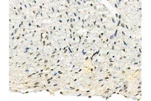 Phospho-TMS1/ASC (Ser195) Antibody at 1/100 staining Rat heart tissue by IHC-P.