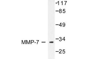 Image no. 1 for anti-Matrix Metallopeptidase 7 (Matrilysin, Uterine) (MMP7) antibody (ABIN265532) (MMP7 antibody)